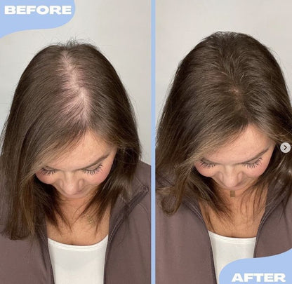 FEG Plus and Strong Hair Growth Spray (Original)