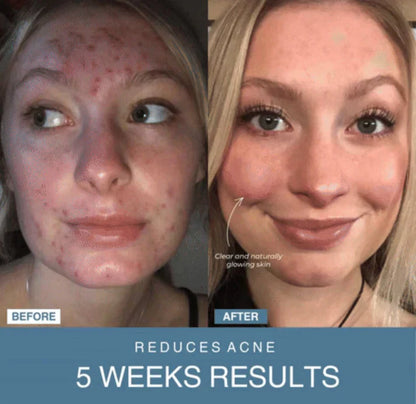 Tijarat™  7-in-1 LED Anti-Aging/Wrinkle Apparatus